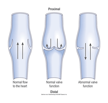 Venous Reflux