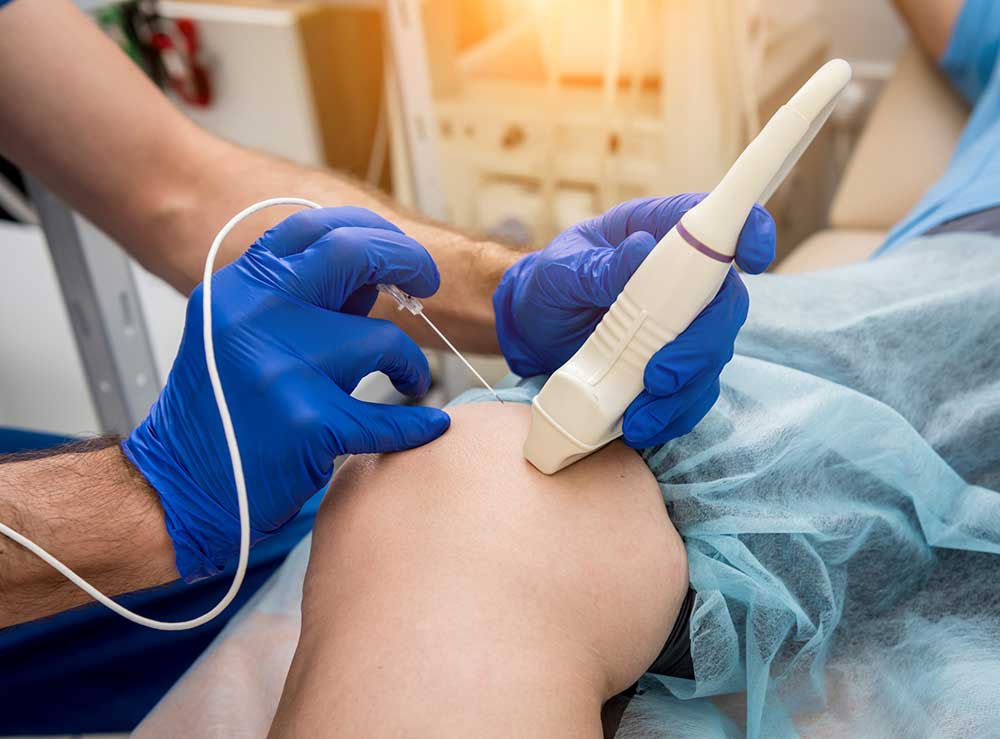 Ablation treatment for varicose veins