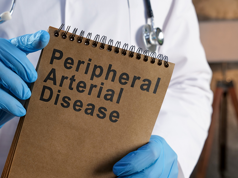Medication Management of Peripheral Artery Disease (PAD)