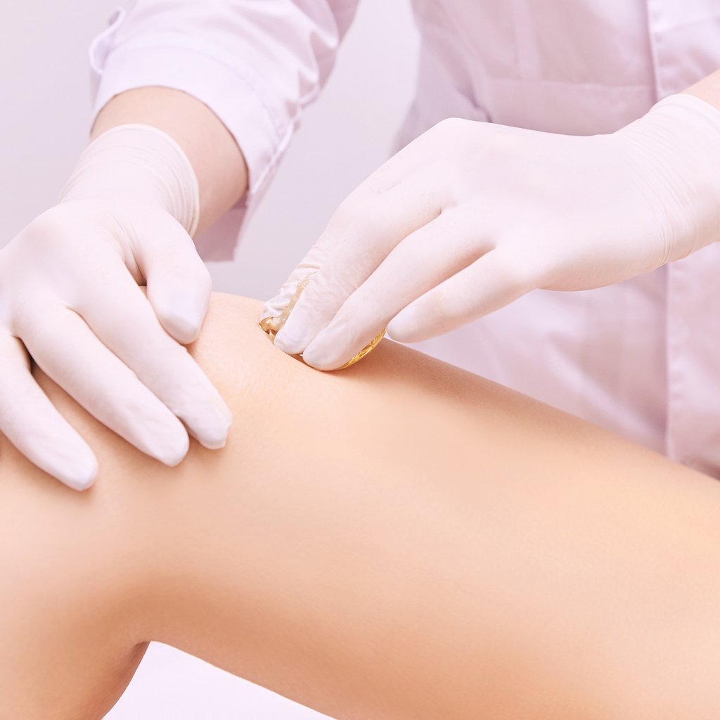 Common Varicose Veins Treatments and Comparisons
