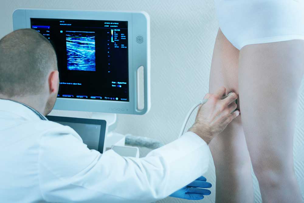 Venous Ultrasound Studies