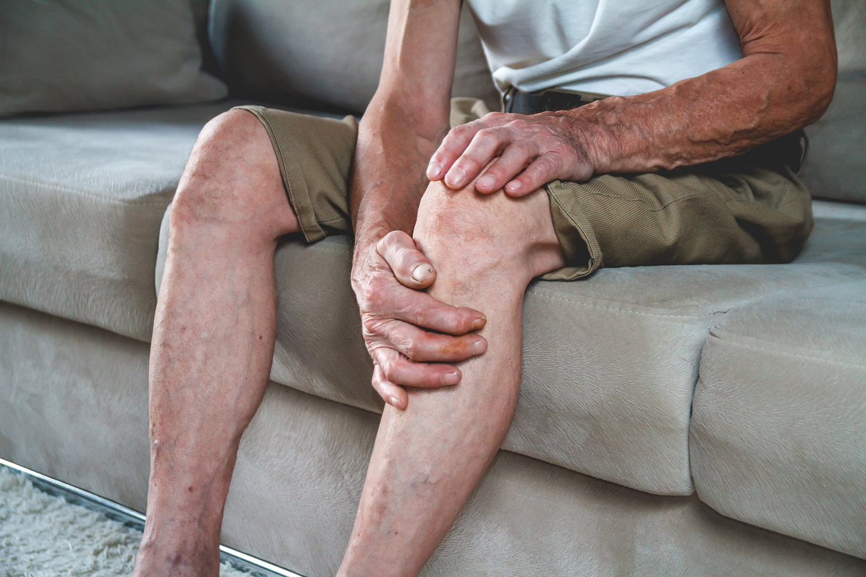 Varicose Vein Issues: Understanding the Unique Challenges Faced by Men