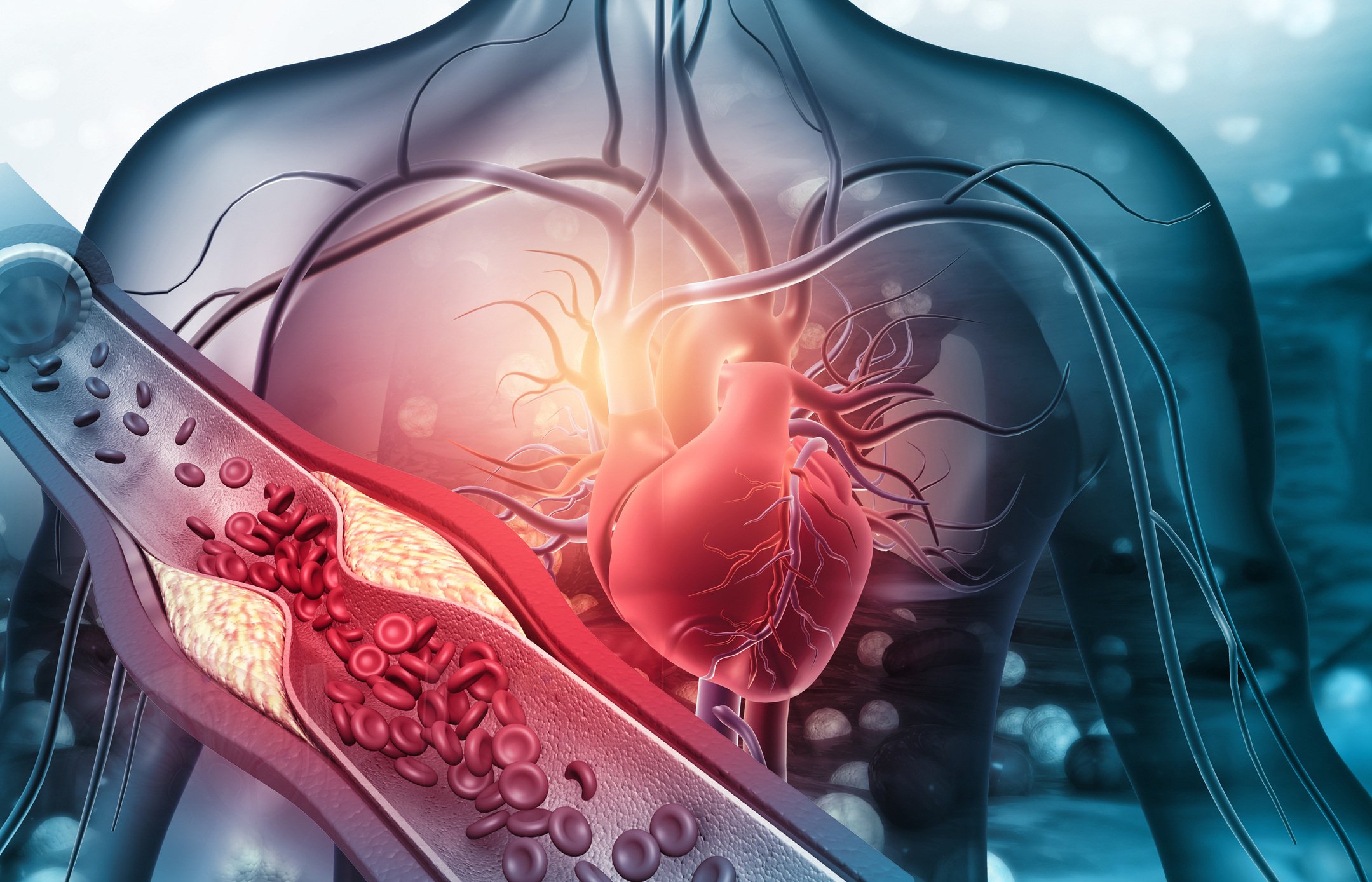 Heart vs. Vascular Disease: Key Similarities and Differences