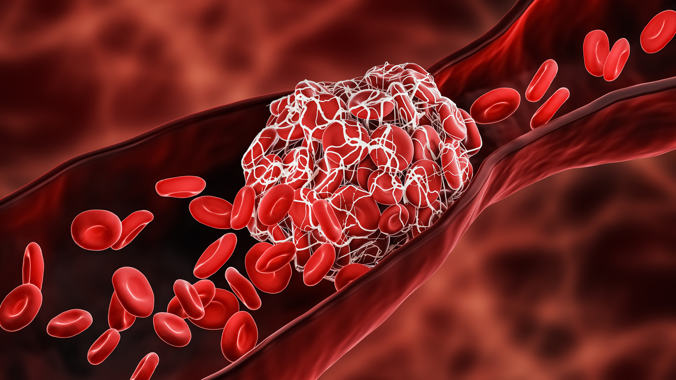 D-dimer blood clot test
