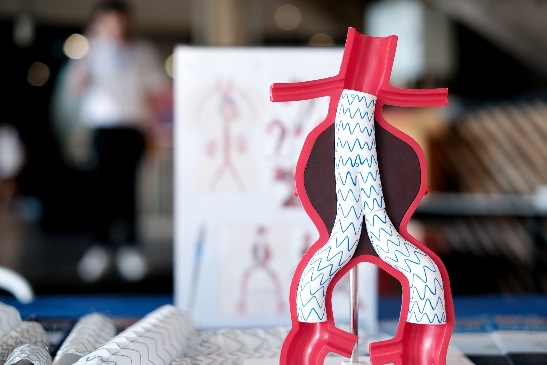 a model of endovascular aneurysm repair (evar) for people education