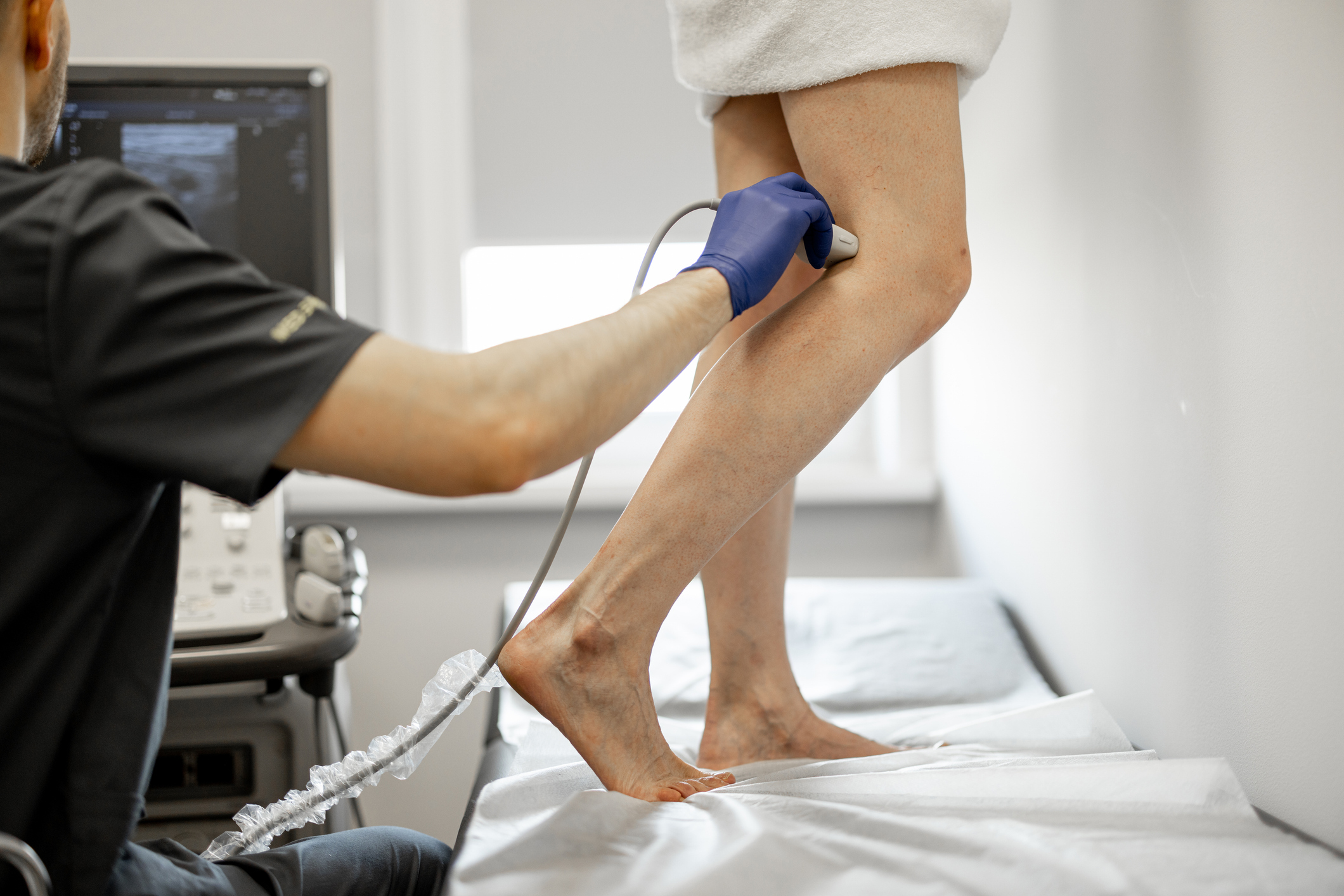 When Should I Be Concerned About a Blood Clot?