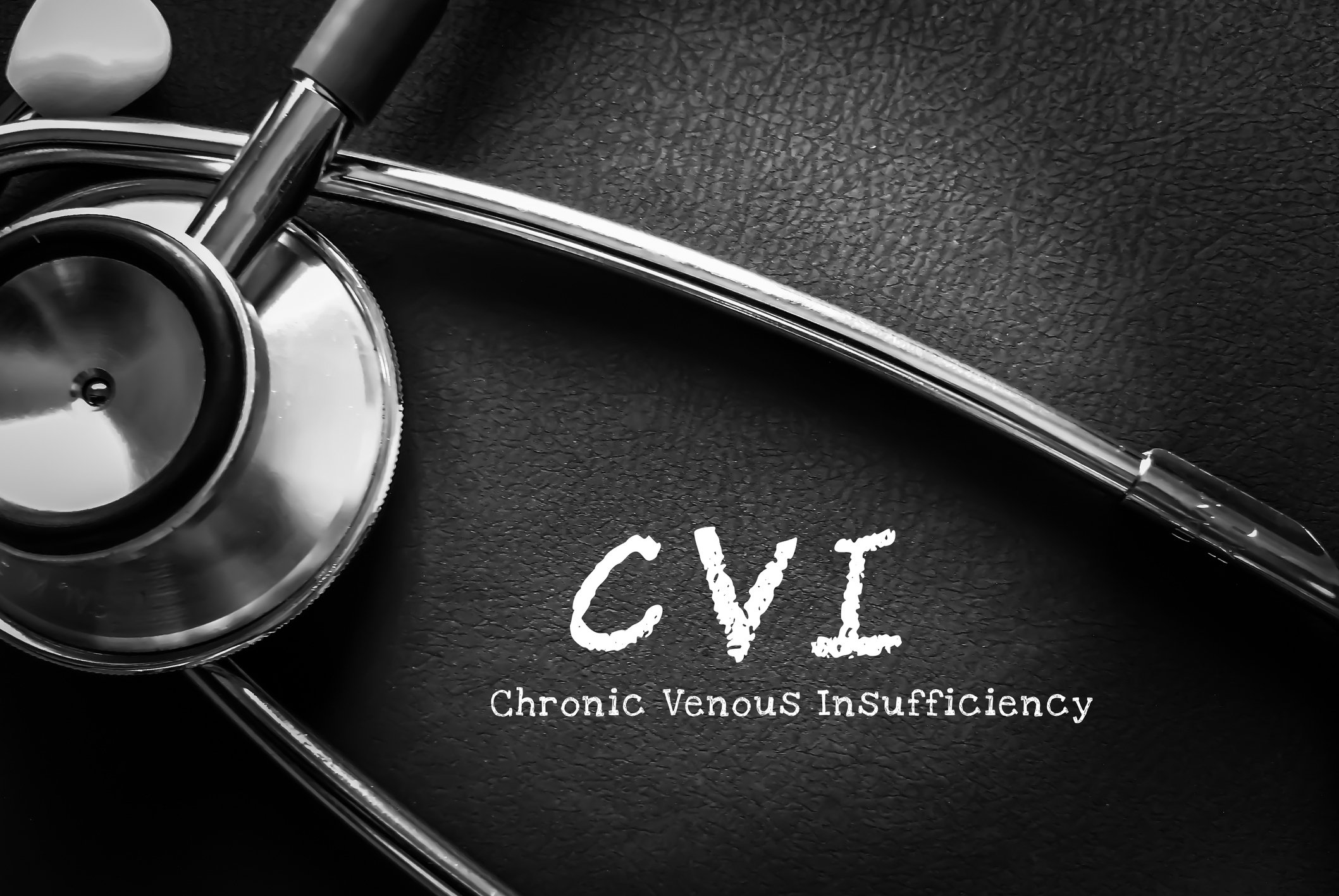Chronic Venous Insufficiency or CVI, a medical condition characterized by blood pooling in the veins, leading to increased pressure and strain on the vein walls.